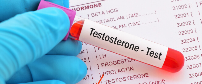 ارتفاع هرمون التستوستيرون لدى النساء