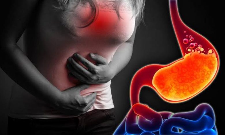 علاج حموضة وحرقة المعدة