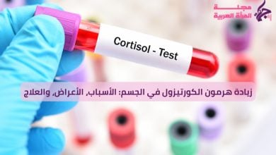 زيادة هرمون الكورتيزول في الجسم