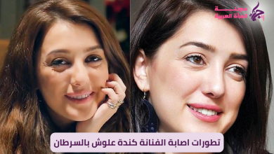 تطورات اصابة الفنانة كندة علوش بالسرطان