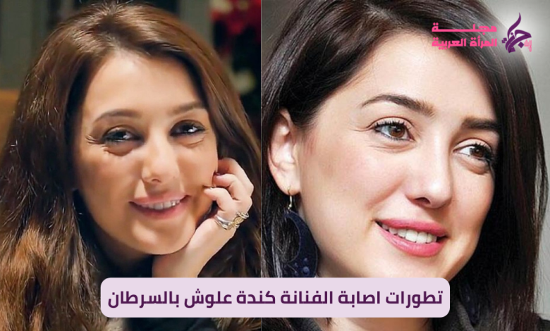 تطورات اصابة الفنانة كندة علوش بالسرطان