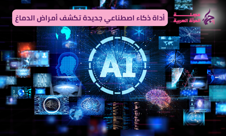 أداة ذكاء اصطناعي جديدة تكشف أمراض الدماغ